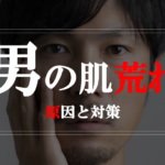 男の肌荒れ原因＆対策