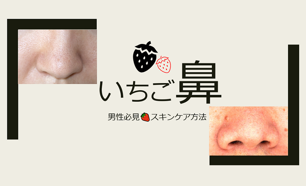いちご鼻スキンケア方法